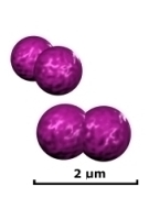 gram-negative diplococci